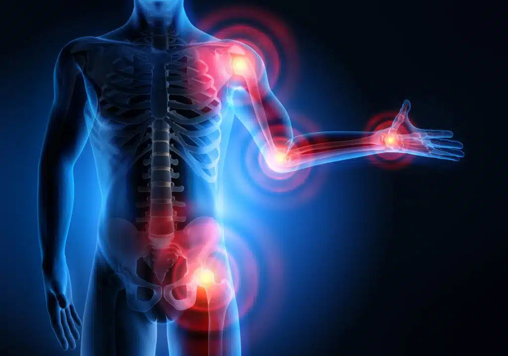 CBD for Arthritis and Stiff Joints: How Every Ingredient in Relief Crème Was Chosen for a Reason